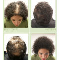 Toppik Haarausfallbehandlung und Haaraufbaufasern zum Verdicken des Haares 12 g (0,42 OZ) Gramm